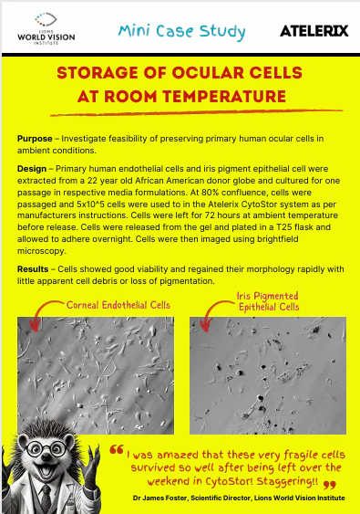 Storage of Ocular Cells at Room Temperature